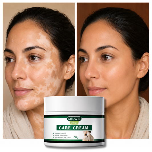 Melavie™ traitement du vitiligo